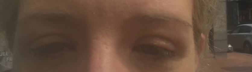 I’m thinking of blepharoplasty.