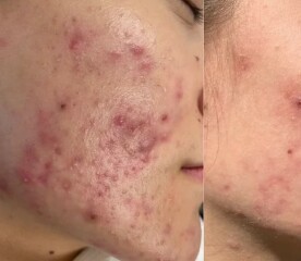 Dd's tutors are saying she absolutely has continue to do this, should I step in?