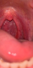 Sobbing with the pain, sore throat?