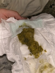 Normal amount of mucus in poo? IMAGES ATTACHED!