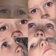 AIBU? Daughter has white eye in flash photo!