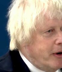 Has Boris Johnson lost an ear (or part of an ear)?