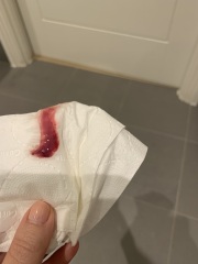 Day 33 of cycle. Any idea what kind of discharge this is.