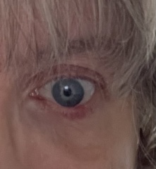 What is this? Eye (pics attached )