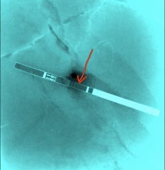 8 days late and only 1 faint line