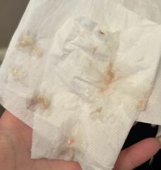 Pink-brown discharge 6 weeks (TMI - pictures in post)