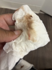 Warning pic attached!! Implantation bleeding?