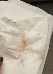 Pink-brown discharge 6 weeks (TMI - pictures in post)