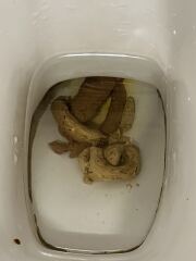 Constant weird pale poos