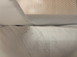 Urgent advise needed- is this bed bugs?
