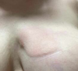 I’m cultivating a third boob, do you want to see it?