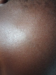 My baby dented her forehead on the skirting board. I am so upset. Pic included.