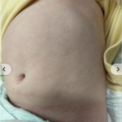 What could this be? Chicken pox?