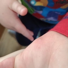 What is this?! Should I be worried?