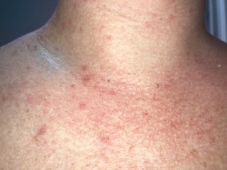 What is this rash? Could it be an allergy?
