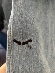 What are these stains and how do I get rid of them