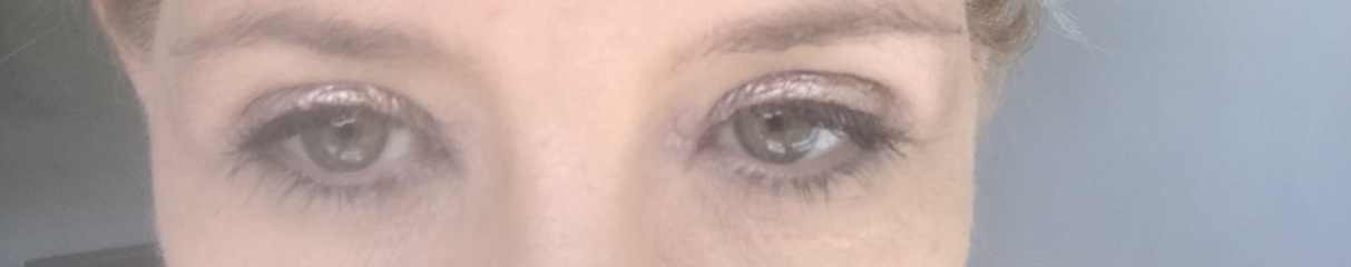 I’m thinking of blepharoplasty.