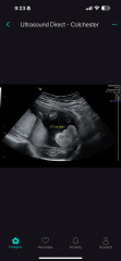 Boy or girl?