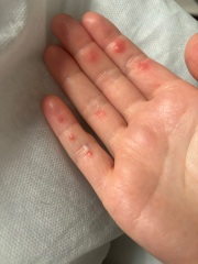 Help! What are these lumps??