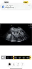 Boy or girl?