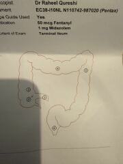 Severe IBS flare ups or something else? I’m miserable here
