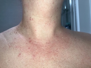 What is this rash? Could it be an allergy?