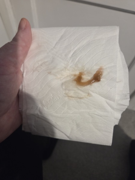 Is this my mucus plug? - TW/TMI - pic attached