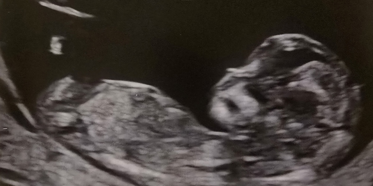 Nub theory - guess the gender?