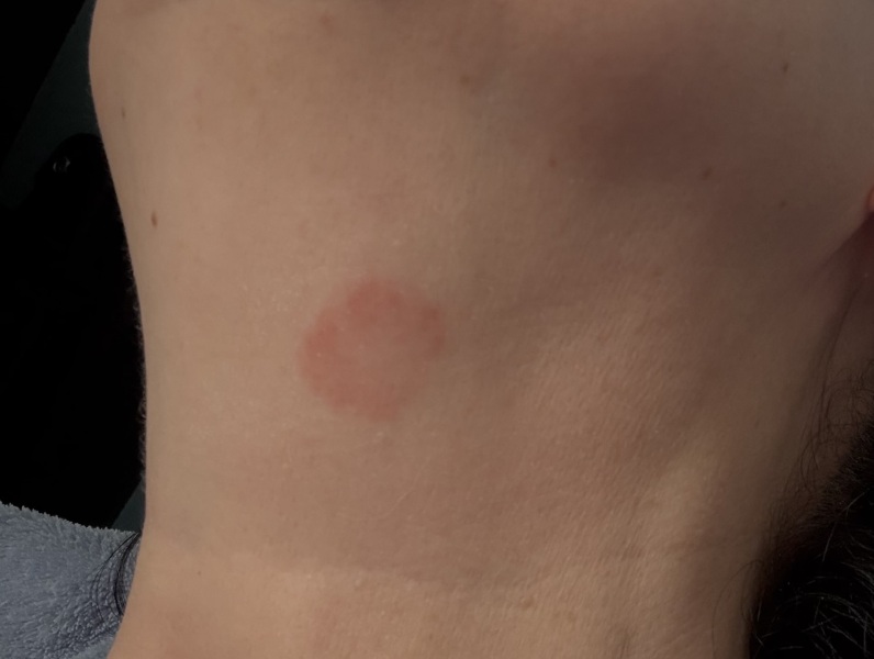Strange red mark