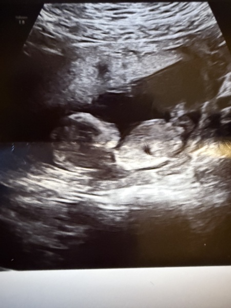 Boy or girl