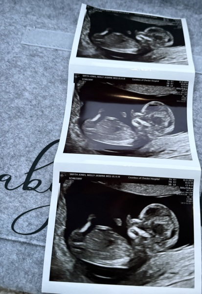 12 week scan…