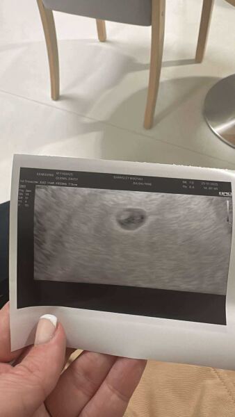 Due July 2026 🤍