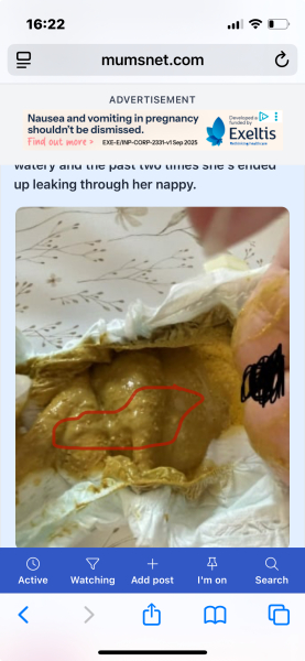 Normal bowel movements?