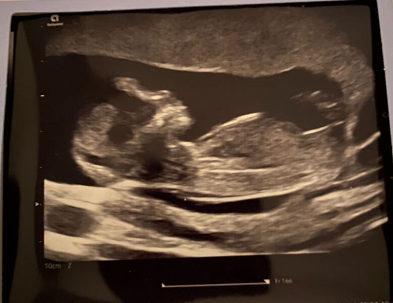 Boy or girl??? Let me know