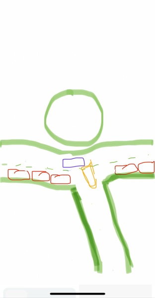 Car crash on roundabout - who’s at fault?