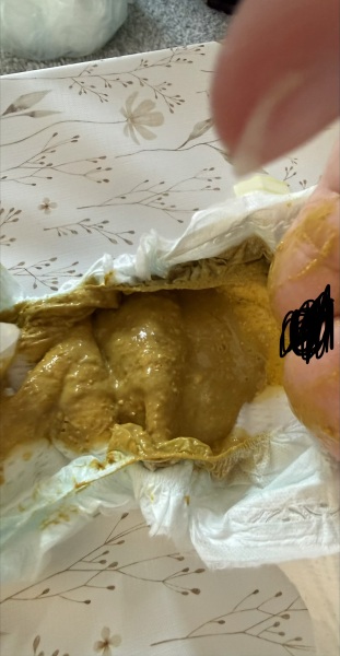 Loose bowel movements