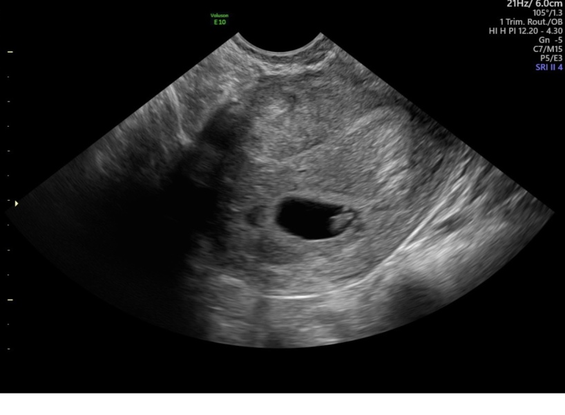 I hate the anxiety and uncertainty that the first trimester brings… anyone else in the same boat?
