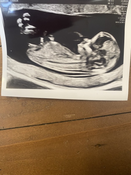 Any gender ideas from my 13 week scan? :)