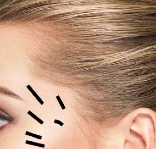 Has anyone used Routine shampoo for thinning hair