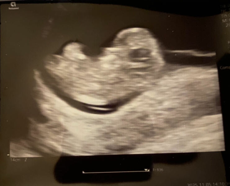 Our little baba🥺