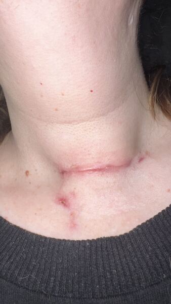 Will this scar get any better?