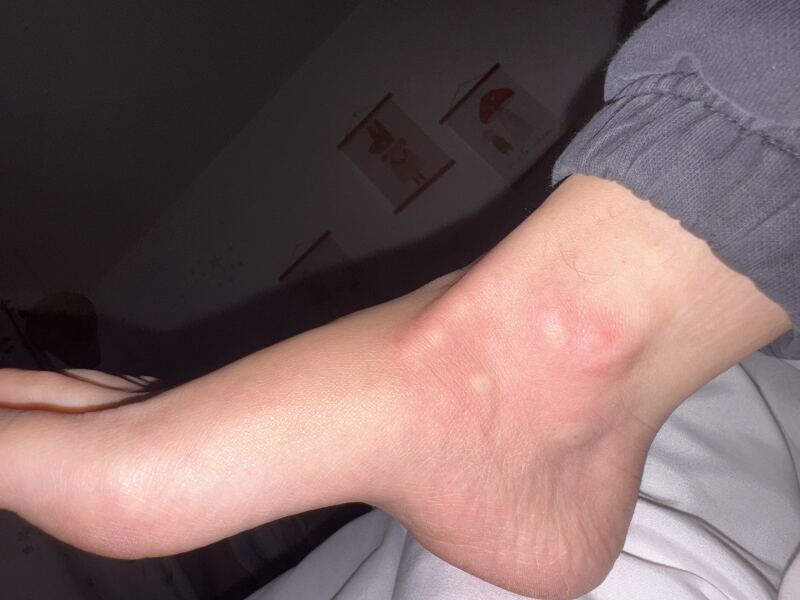 To think I’ve been bitten by a monster?