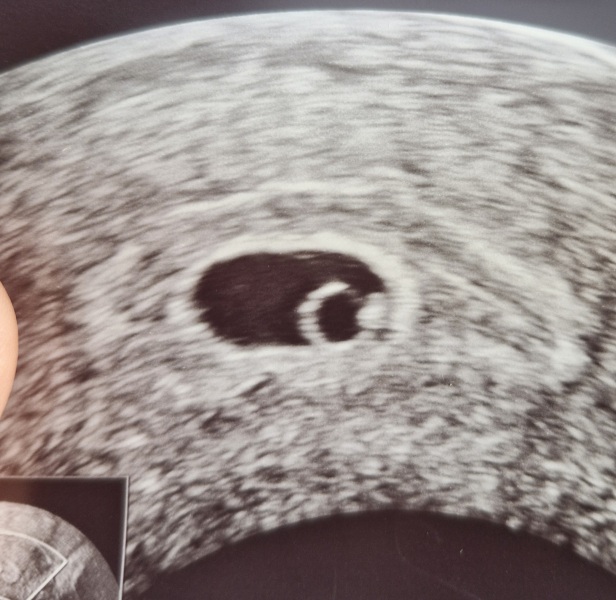 Due July 2026 🤍