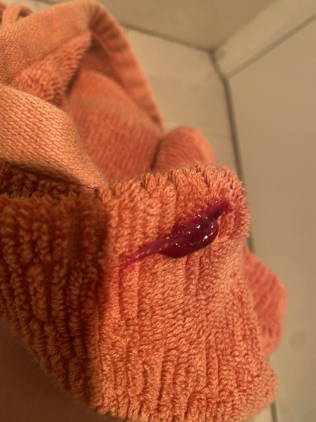 Is this a miscarriage