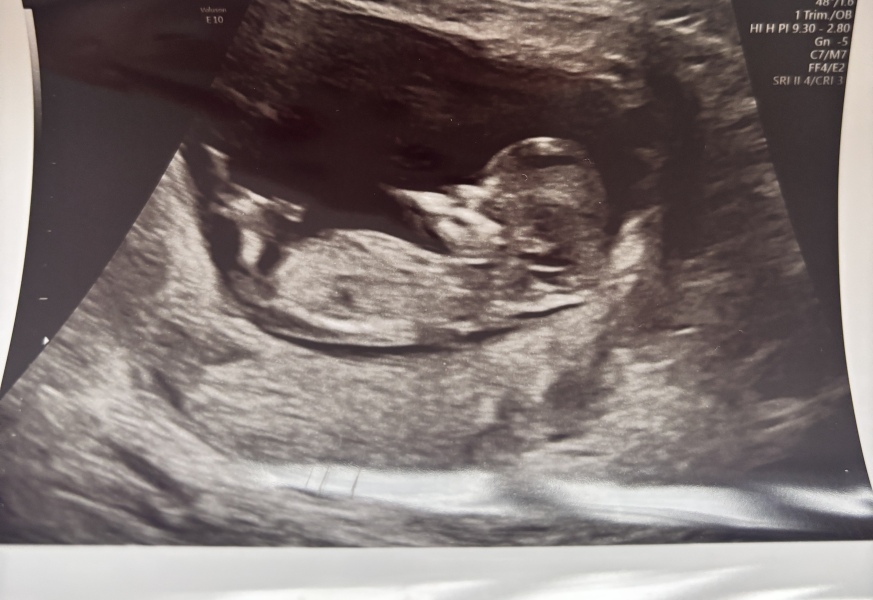 Nub theory 🩵🩷