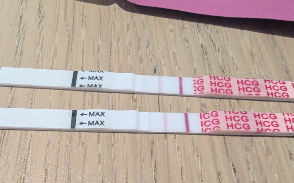 Test not fading after surgical management