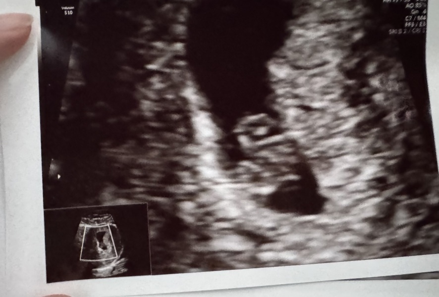 TTC Baby #3 Not our first rodeo 🤠