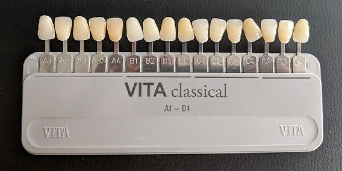 Help! Need to choose new veneer colour asap - A1 or B1