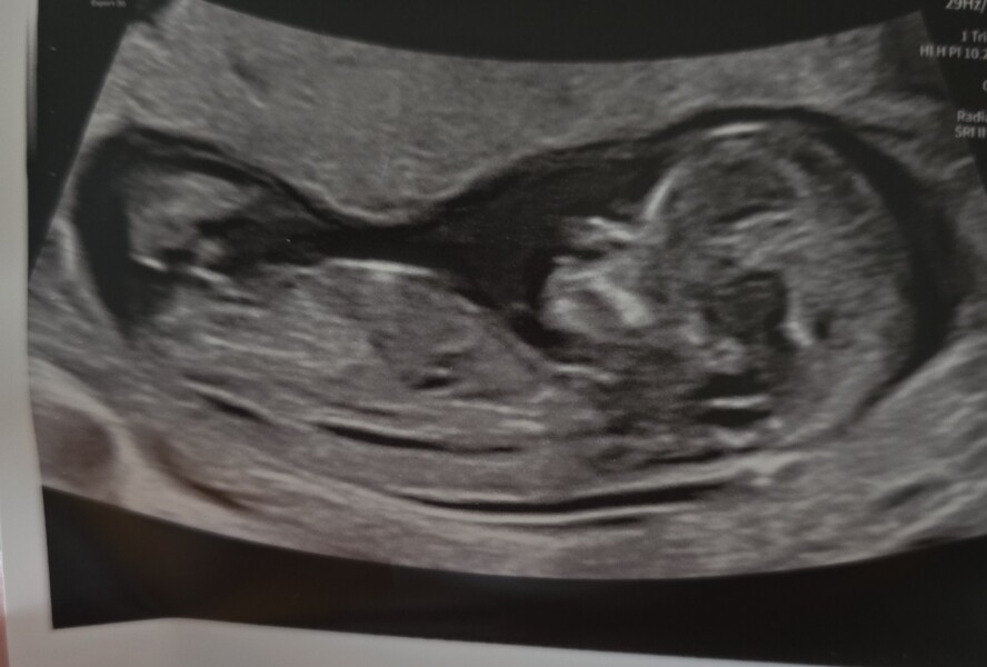 Boy or girl