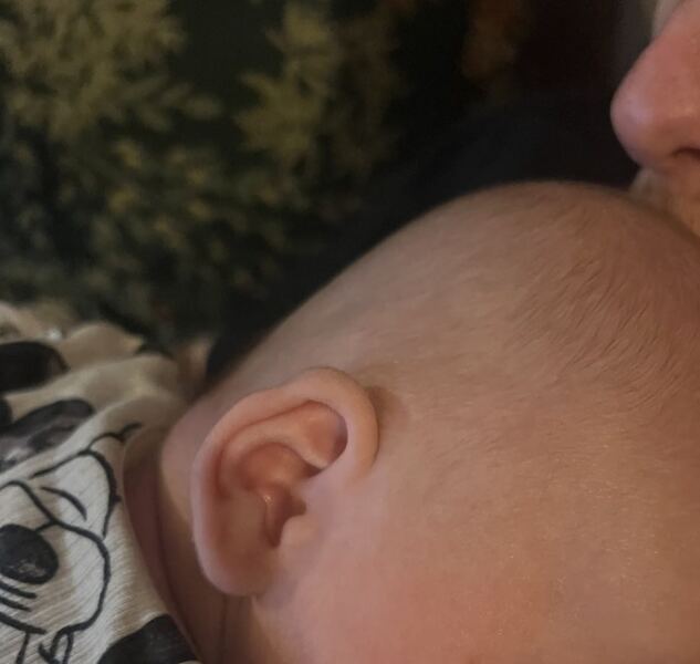 How bad is my son's plagiocephaly/flat head?